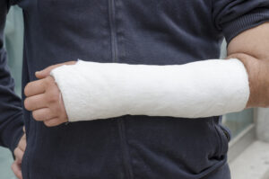 A person's arm in a cast